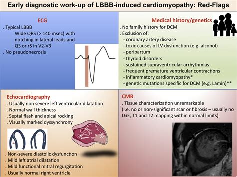 Left Bundle Branch Block Induced Cardiomyopathy A Diagnostic Proposal For A Poorly Explored