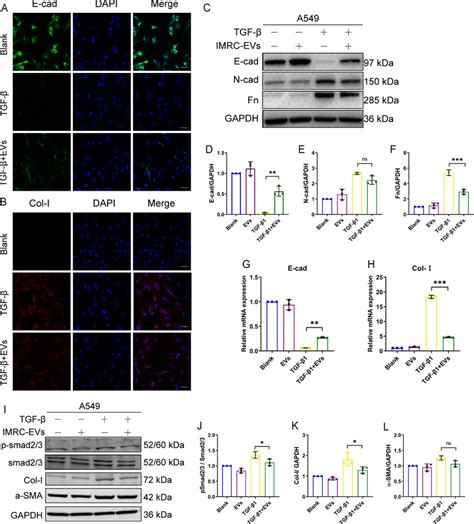 Imrc Evs Inhibit Tgf Induced Emt In Vitro Immunofluorescence