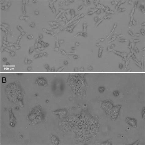 Phase Contrast Images Taken Of The Atcc® Adipose Derived Mesenchymal Download Scientific