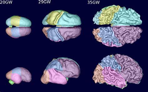 New technology images fetal brain activity in 4D | UW Bioengineering