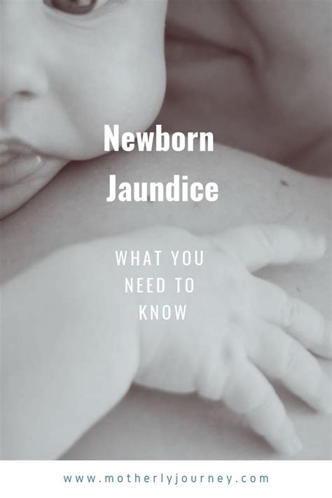 What You Need To Know About Newborn Jaundice Artofit