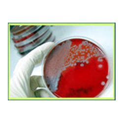 Microbiological Screening Service In Mumbai ID 9508787062