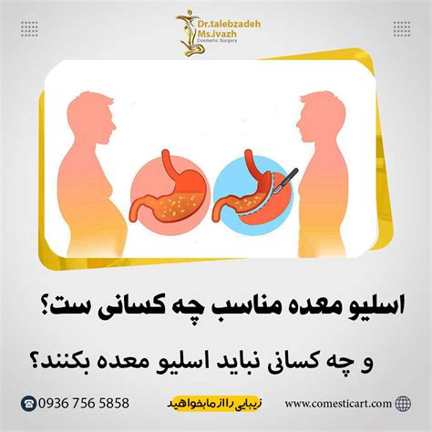 صفر تا صد عمل اسلیو معده را بدانید کلینیک جراحی زیبایی ایواز