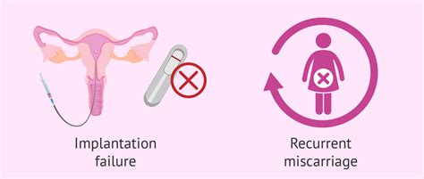 Recurrent Miscarriage - ART Compass- IVF Lab Management Software