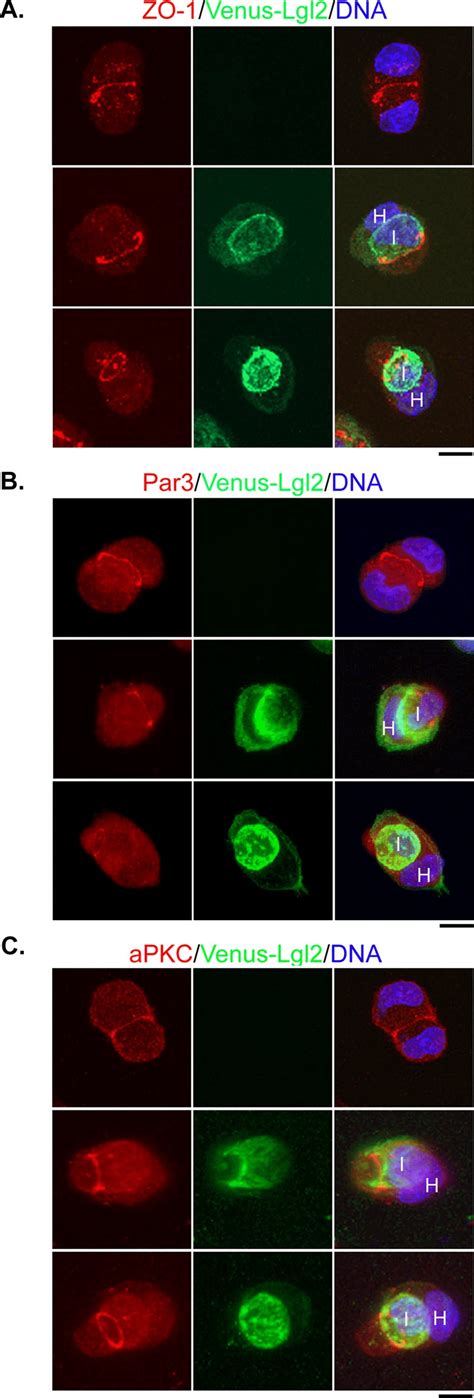 Localization Of Apical Junctional Proteins In Control And Internalizing