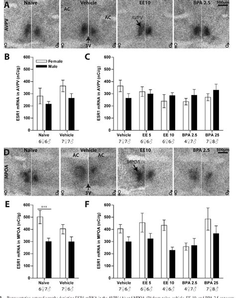 Figure 1 From Prenatal Bisphenol A Exposure Alters Sex Specific