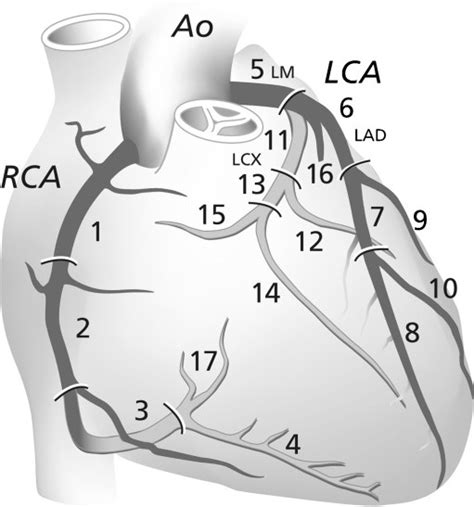 Coronary Artery Segments According To The American Hear Open I