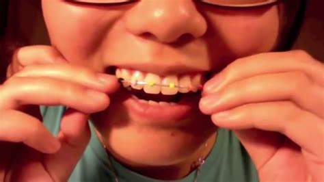 Tutorial How To Make Fake Braces That Look Real Youtube