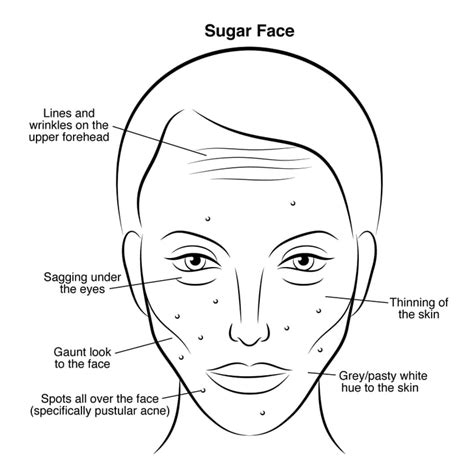 Sugar Face Gut Health And Skin Problems Popsugar Beauty Photo 4