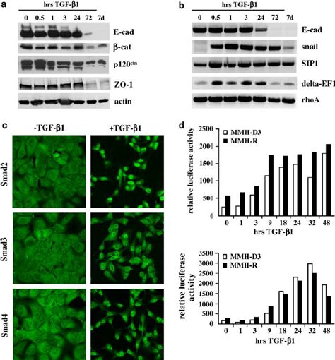 E Cadherin Repression And Tgf B Signalling Properties During