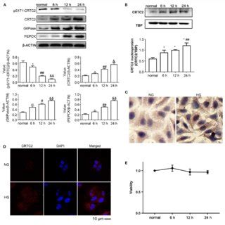 Effects Of High Glucose On The CRTC2 Signaling Pathway In HepG2