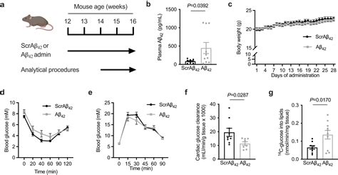 Research reveals new hope for obesity-induced heart disease