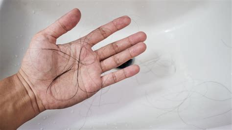 Caída Del Cabello Cuáles Son Las Causas Cómo Prevenirla Y Qué