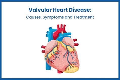 Valvular Heart Disease Causes Symptoms And Treatment