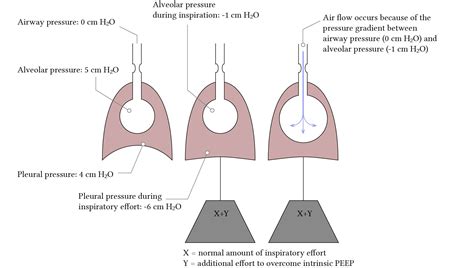 Intrinsic Peep And Positive Pressure Ventilation Deranged Physiology