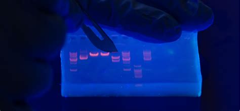 How To Interpret Dna Gel Electrophoresis Results Goldbio