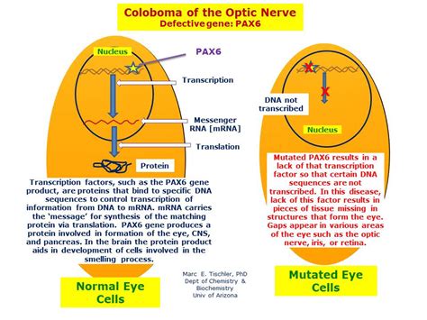 Coloboma of the Optic Nerve | Hereditary Ocular Diseases