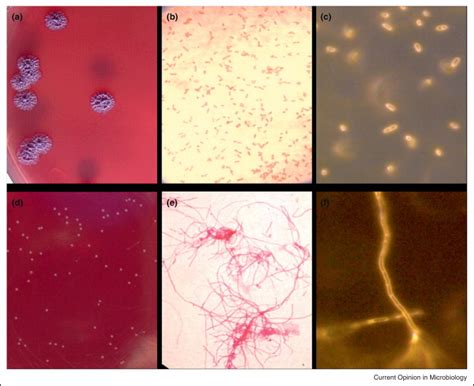 Comparison Of The Appearance Of An Initial Ceftazidime Susceptible B Download Scientific