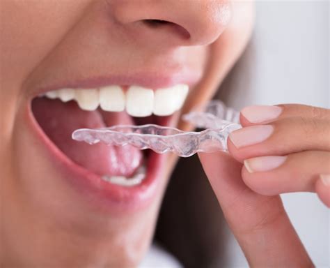 Bruxism Treatment - Michael C. Toms, DDS