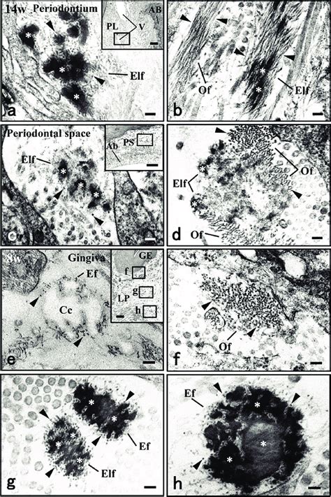 Showing Electron Microscopic Photographs Of Elastic System Fibers