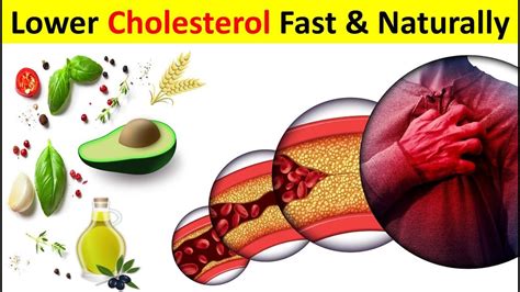 Best Foods To Lower Cholesterol Fast Naturally At Home Effect Of Cholesterol On Our Body Youtube