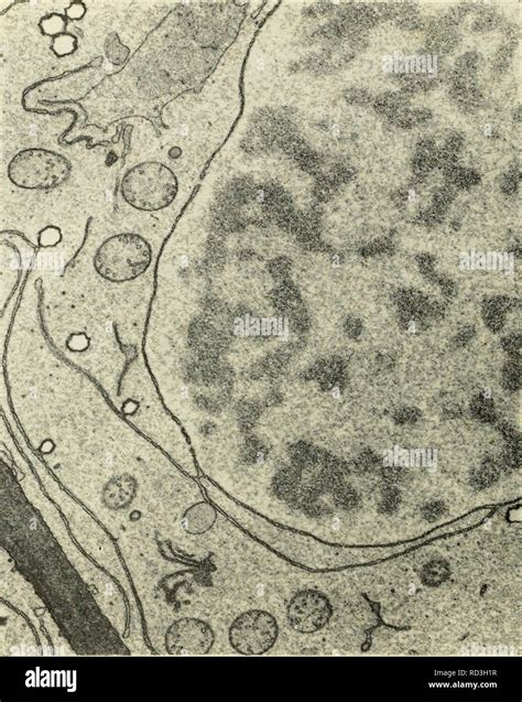 Cytology Cytology Various Elements Of The Endoplasmic Reticulum