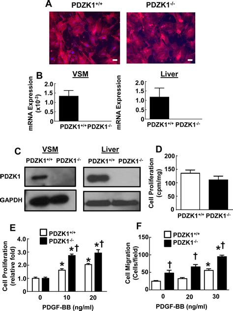 Vsm Cells From Pdzk Mice Display Enhanced Pdgf Stimulated Cell