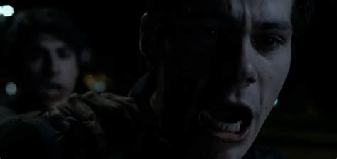 Image Teen Wolf Season 5 Episode 4 Condition Terminal Stiles Attacked