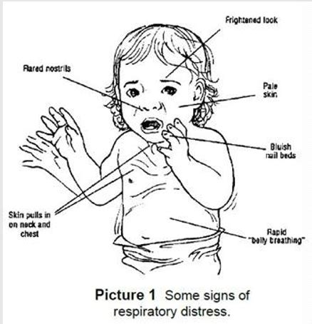 Paediatric Anatomy And Cr Flashcards Quizlet