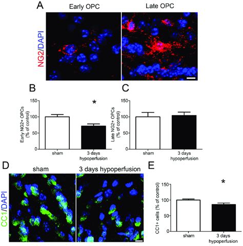 Reduced Numbers Of OPCs And Mature Oligodendrocytes After 3 Days Of