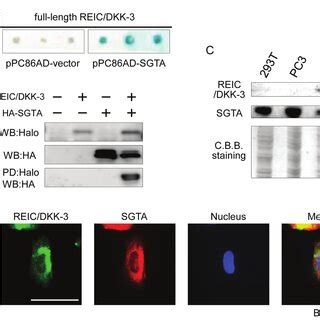 The Role Of The Reic Dkk Sgta Interaction In Ar Signaling The