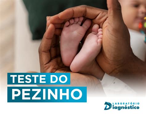 Teste do Pezinho Laboratório Diagnóstico Anápolis Goiás