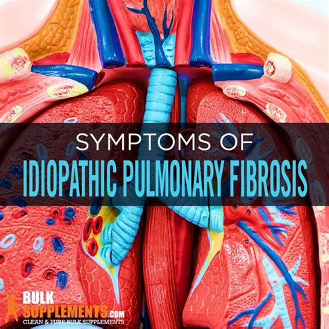 Idiopathic Pulmonary Fibrosis Symptoms Causes Treatment