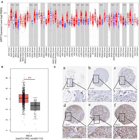 A Human Sirtuin Sirt Expression Levels In Different Tumor Types