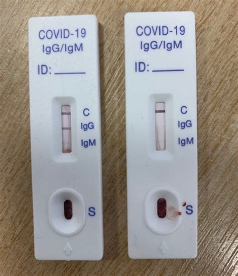 Coronavirus Doctors Diary So Did The Bradford Choir Have Covid 19 In