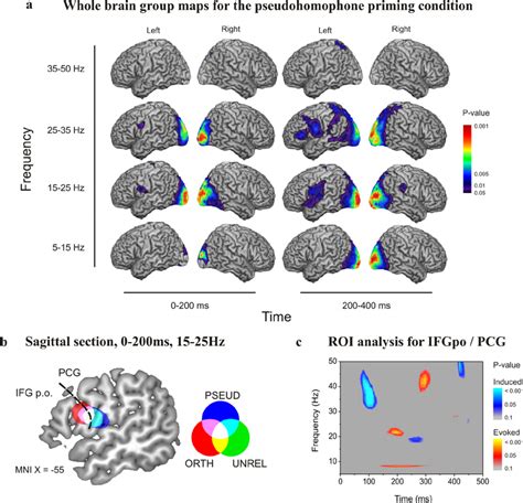 a , Three-dimensional rendered cortical representations showing ...