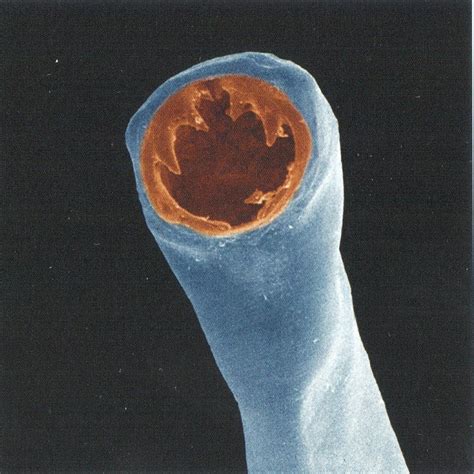 Hookworms - Bayside Animal Medical Center