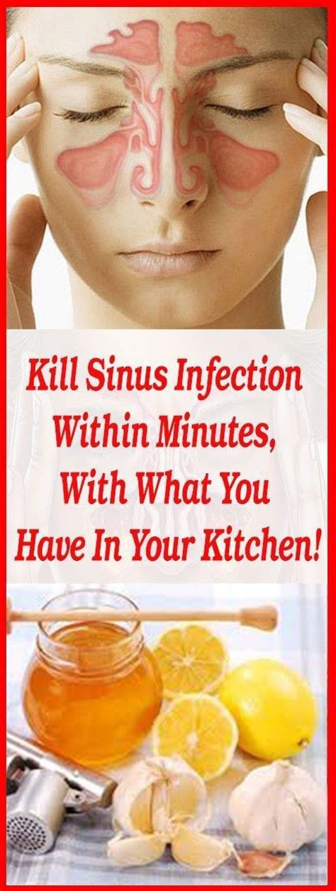 Will Allergy Medicine Help Sinus Infection