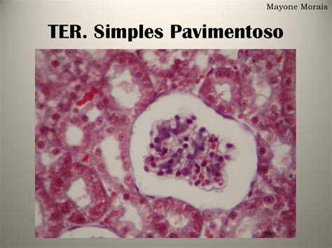 Tecido Epitelial De Revestimento Simples Pavimentoso LIBRAIN