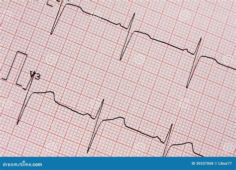 Electrocardiogram Printout Stock Photo Image Of Closeup 30337068