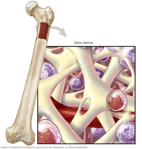 Aplastic anemia Disease Reference Guide - Drugs.com