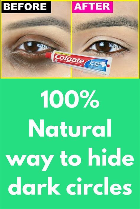 How To Use Colgate And Vaseline To Get Rid Of Dark Spots On The Face In