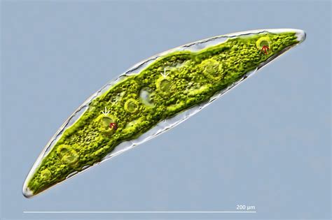 Pyrenoide In Closterium