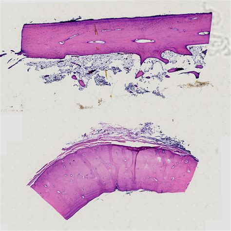 Decalcified Compact Bone L S C S Show Osteon And Haversian System