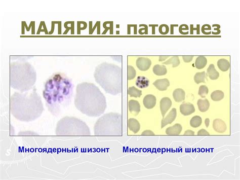 Малярия - презентация онлайн