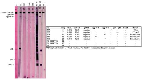 Htlv 1 2 In Indigenous Peoples Of The Brazilian Amazon Seroprevalence