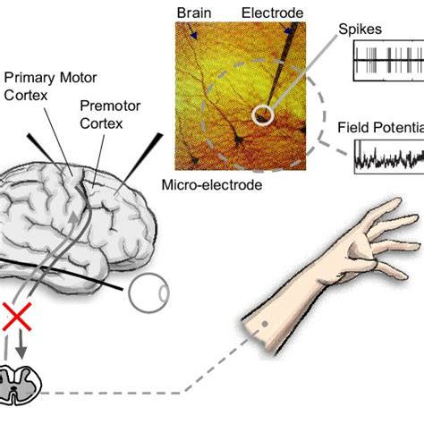 (PDF) Cognitive Based Neural Prosthetics