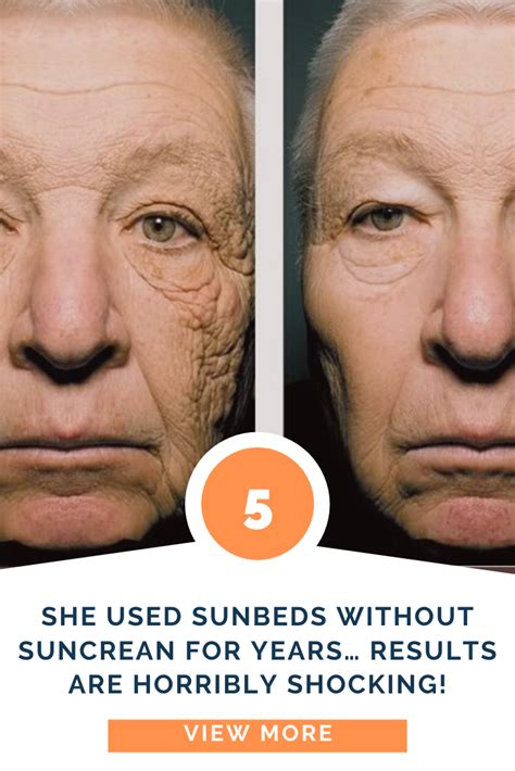 She Used Sunbeds Without Suncrean For Years… Results Are Horribly