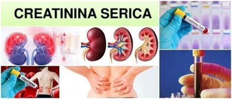 Creatinina S Rica Qu Es An Lisis De Sangre Tasa De Filtraci N