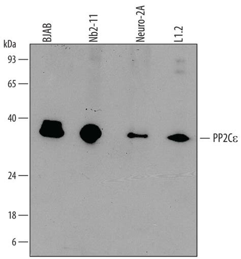 Humanmouserat Pp2c Epsilonppm1l Antibody R 100ug Unlabeled